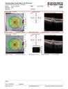 PatternDystrophy_96645_fu_25.JPG