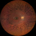 RP_rarei_071519_01.png