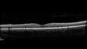 Torpedo_brwhi_080219_17.jpg