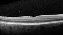 Toxoplasmosis_kedeg_08062020_03.jpg