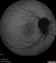 Trauma-PPHeme_111390_06072022_04.jpg