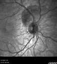 Trauma-PPHeme_111390_06072022_06.jpg