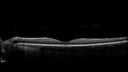 Trauma-PPHeme_111390_06072022_09.jpg