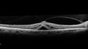 VMT-machole-nabr-031218-05.jpg