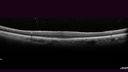 VMT-machole-nabr-051218-09.jpg
