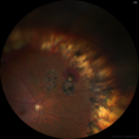 VPT_mburn_12129_01.png