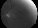 ablinismrc_28429.jpg