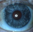 ablinismrc_28729.jpg