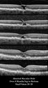 abortedMH-BoMc-1017-0618.jpg