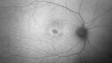 achromatopsia_117514_11082023_05.jpg