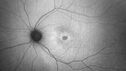 achromatopsia_117514_11082023_06.jpg