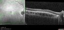achromatopsia_117514_11082023_08.jpg