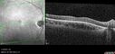 achromatopsia_117514_11082023_09.jpg
