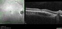 achromatopsia_117514_11082023_10.jpg
