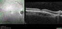 achromatopsia_117514_11082023_11.jpg