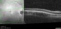 achromatopsia_117514_11082023_19.jpg