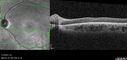 achromatopsia_117514_11082023_20.jpg