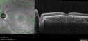 achromatopsia_117514_11082023_26.jpg