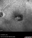 amd_heme_jste_061615_18.jpg