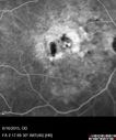 amd_heme_jste_061615_19.jpg