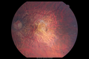 amd_lighttoxicityOS_bech_mixedates_02.png