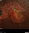 amd_lighttoxicityOS_bech_mixedates_04.jpg