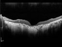 amd_lighttoxicityOS_bech_mixedates_08.jpg
