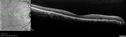angioidS_miba_051915_13.jpg