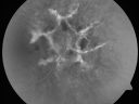 angioidcnam_jasc_281129.jpg