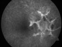 angioidcnam_jasc_281229.jpg