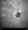 apmppe4_rofa_110915_08.jpg