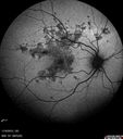 apmppe4_rofa_110915_11.jpg