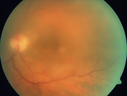 arn_jacl_030618_02.png