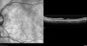 atheromata_BRAO_yvad_050817_16.jpg
