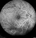 atheromata_BRAO_yvad_050817_22.jpg