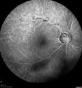 atheromata_BRAO_yvad_050817_25.jpg
