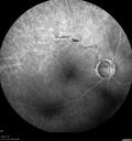 atheromata_BRAO_yvad_050817_26.jpg