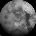 autoimmune-csr_rilo_020915_05.jpg