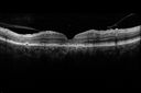 autoimmune-csr_rilo_020915_11.jpg