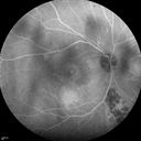 autoimmune-csr_rilo_020915_19.jpg