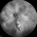 autoimmune-csr_rilo_020915_20.jpg