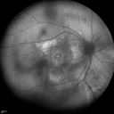 autoimmune-csr_rilo_020915_22.jpg