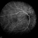 autoimmune-csr_rilo_020915_28.jpg