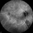 autoimmune-csr_rilo_020915_31.jpg