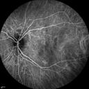autoimmune-csr_rilo_020915_32.jpg
