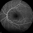 azoor2_3monthsosall06.png