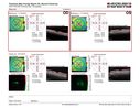bdr-ischemia_lucas_062618_05.JPG