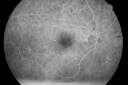 bdrlaser_nira_281029.png