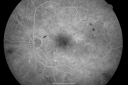 bdrlaser_nira_281129.png