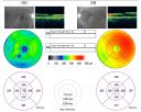 bdrlaser_nira_281629.jpg